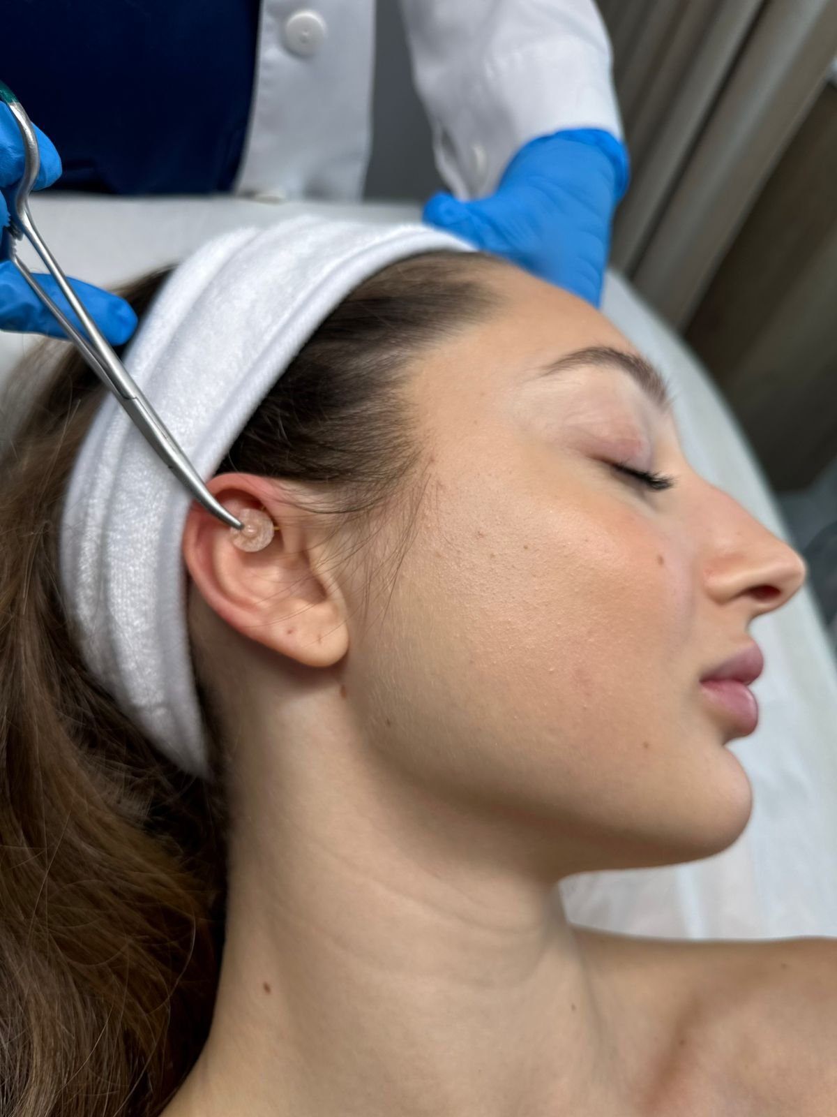 Ιατρικός Βελονισμός